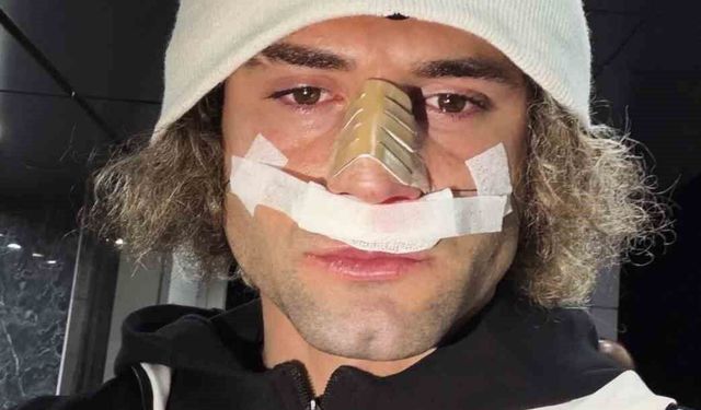 ELAZIĞSPOR'DA FUAT BAVUK'UN BURNU KIRILDI